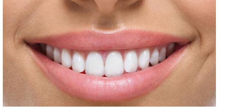 Full mouth rehabilitation/ FMR